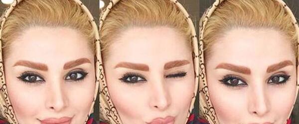 عکس دنیا قبل از عمل