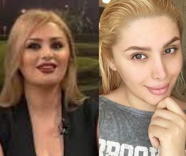 عکس دنیا قبل از عمل