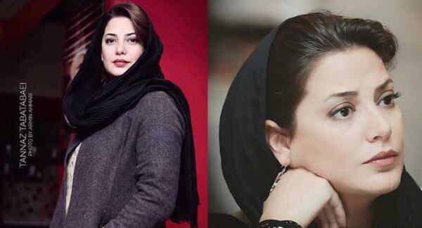 عکس طناز طباطبایی قبل از عمل زیبایی