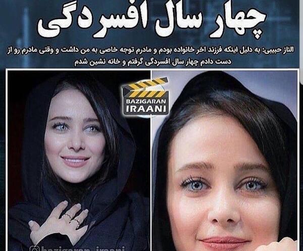 عکس الناز حبیبی قبل از عمل دماغ