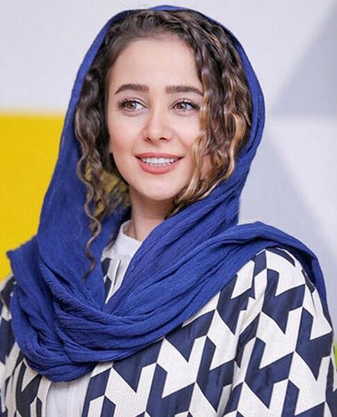عکس الناز حبیبی قبل از عمل دماغ