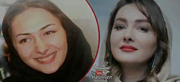 عکس شهاب حسینی قبل از عمل بینی
