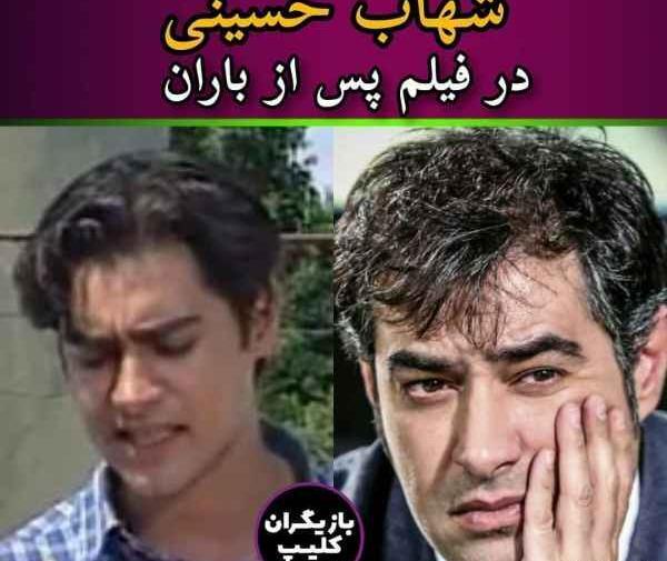 عکس شهاب حسینی قبل از عمل بینی