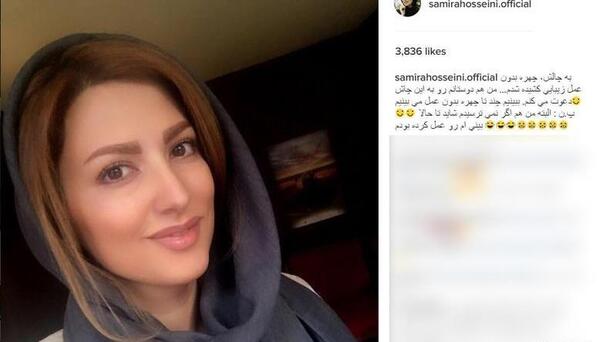 عکس شهاب حسینی قبل از عمل بینی