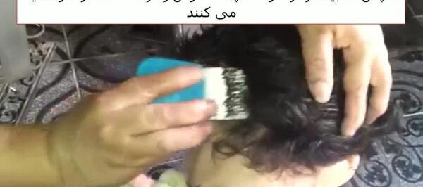 عکس شپش وحشتناک