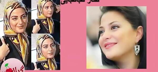 عکس زلیخا قبل از عمل