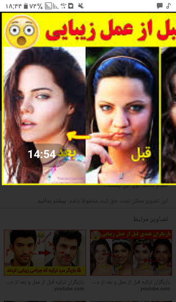 عکس زلیخا قبل از عمل
