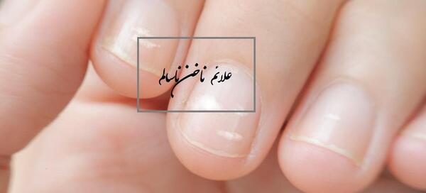 عکس ناخن ناسالم