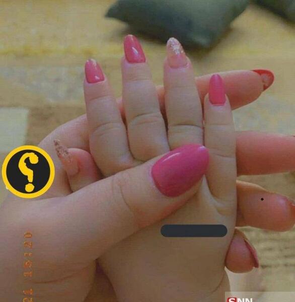 عکس ناخن ناسالم