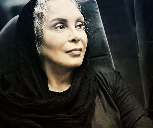 عکس افسانه بایگان قبل و بعد از عمل