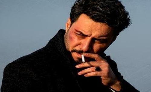 عکس جواد عزتی در زخم کاری