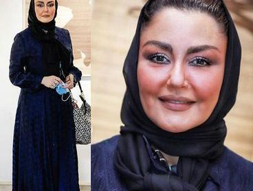 عکس ماشین شقایق فراهانی