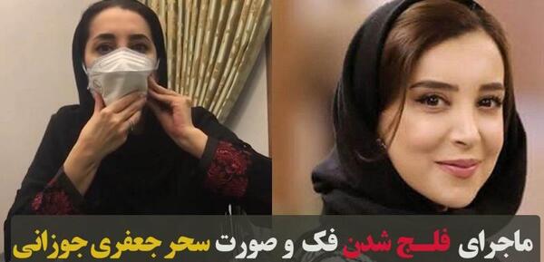 عکس سحر جعفری جوزانی فلج شدن فک