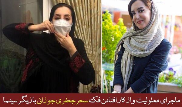 عکس سحر جعفری جوزانی فلج شدن فک