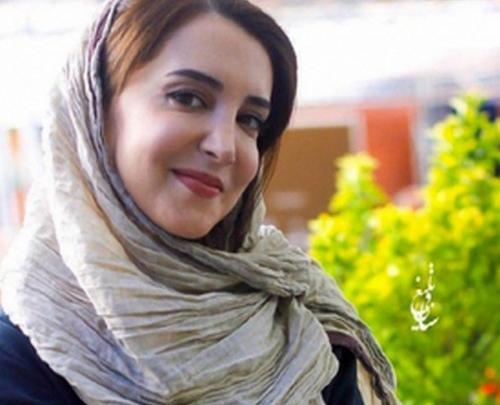 عکس سحر جعفری جوزانی فلج شدن فک