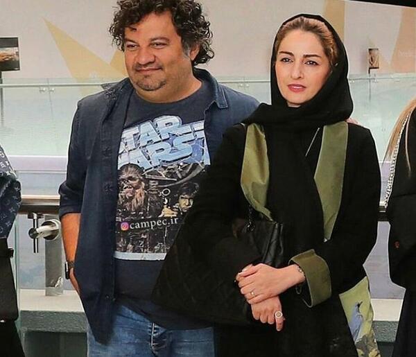 عکس شقایق دهقان قبل عمل