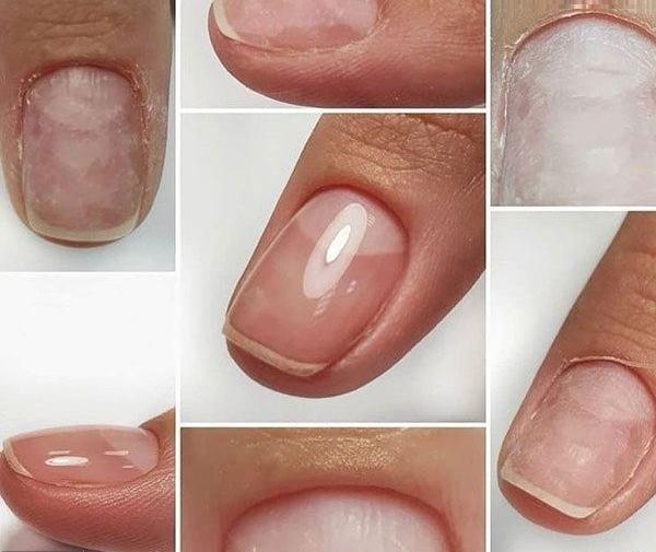 عکس ناخن لمینت شده