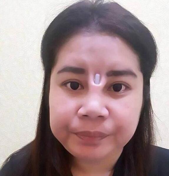 عکس بلک پینک قبل عمل