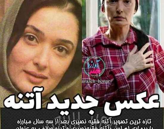عکس بیماری اتنه فقیه نصیری