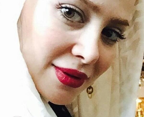 عکس چشم الناز حبیبی