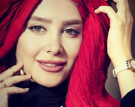 عکس الناز حبیبی قبل و بعد از عمل