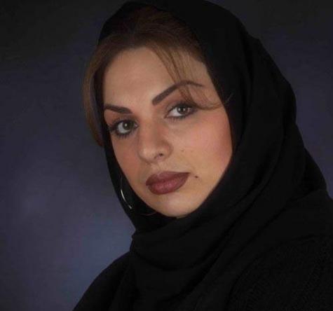 عکس الیزابت امینی بعد از عمل