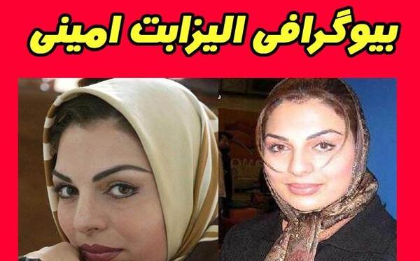 عکس الیزابت امینی بعد از عمل