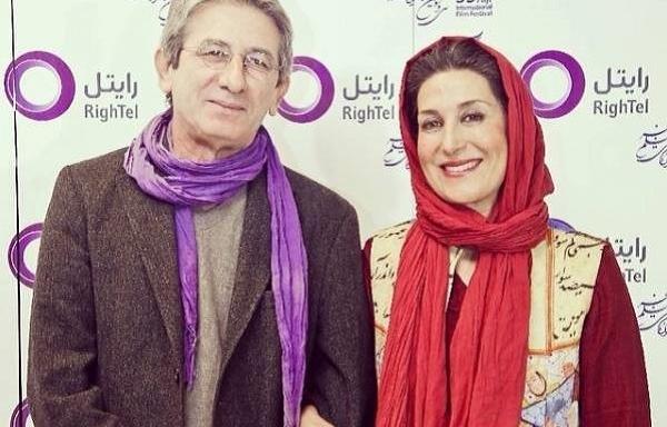 عکس قبل از عمل فاطمه معتمد آریا