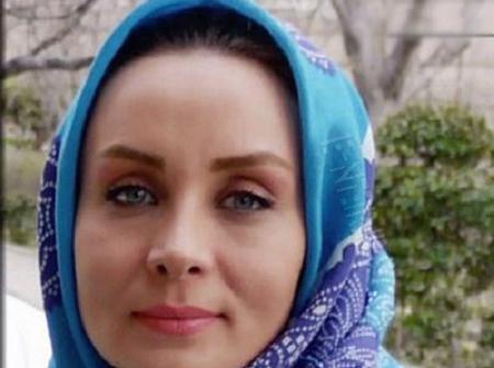 عکس حدیث فولادوند قبل و بعد از عمل