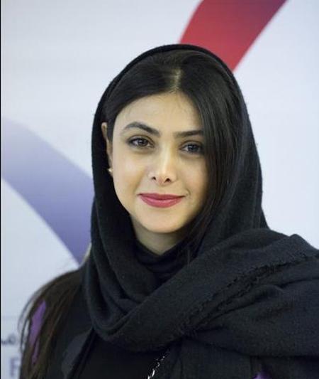 عکس های آزاده صمدی قبل از عمل زیبایی