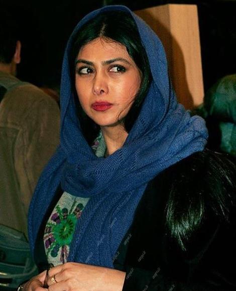 عکس های آزاده صمدی قبل از عمل زیبایی