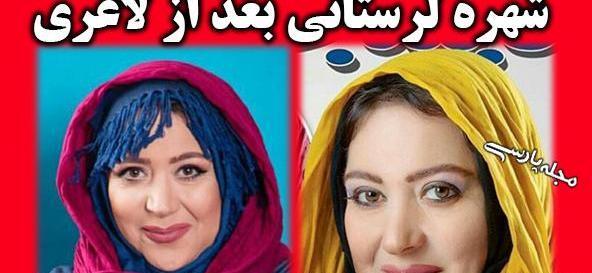عکس چاقی و لاغری شهره لرستانی