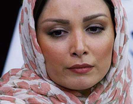 عکس فرناز رهنما قبل از عمل بینی