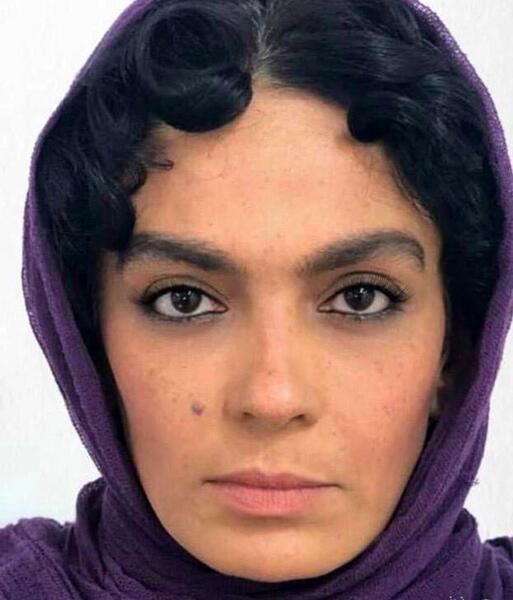 عکس سارا خوئینی ها قبل عمل