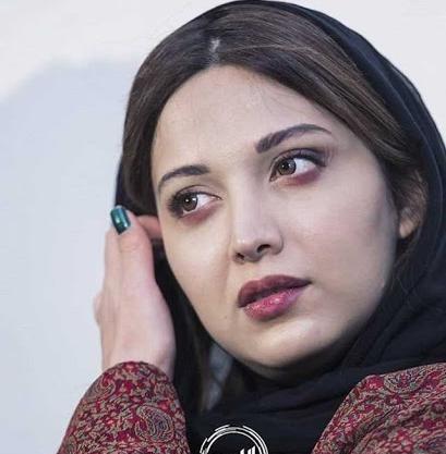 عکس روشنک گرامی بعد از تصادف