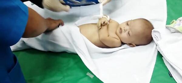عکس نوزاد فوت شده
