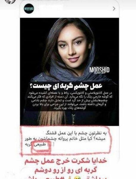 عکس چشم گربه ای ترلان پروانه