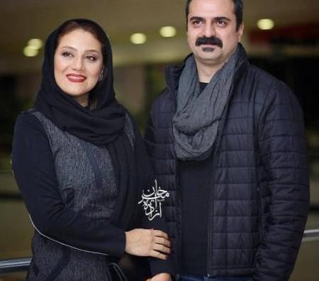 عکس شبنم مقدمی قبل از عمل