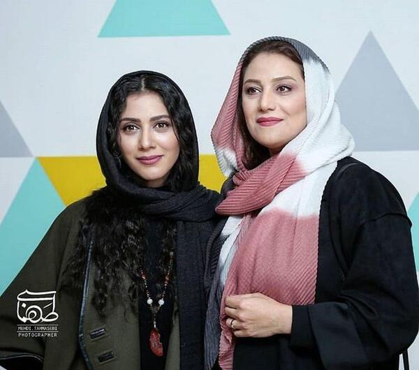عکس شبنم مقدمی قبل از عمل