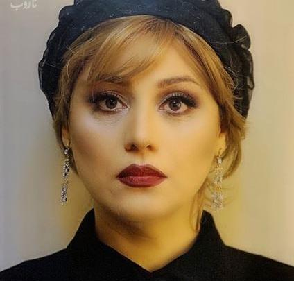 عکس شبنم مقدمی قبل از عمل