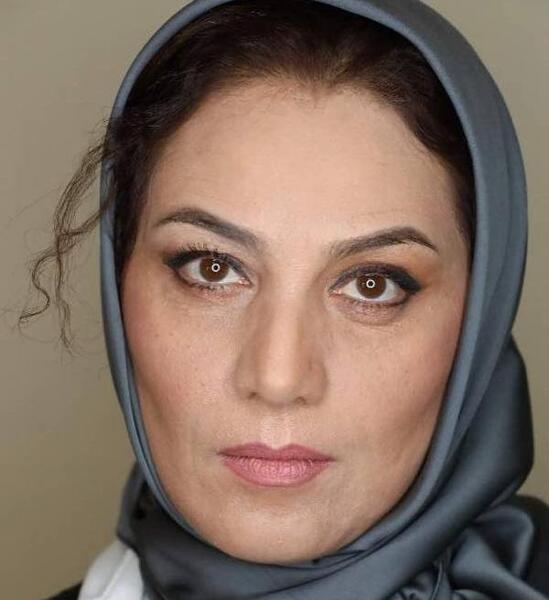 عکس شبنم مقدمی قبل از عمل