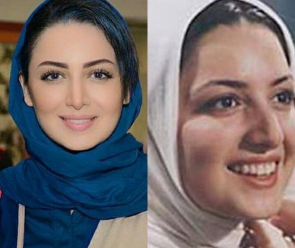 عکس شبنم مقدمی قبل از عمل