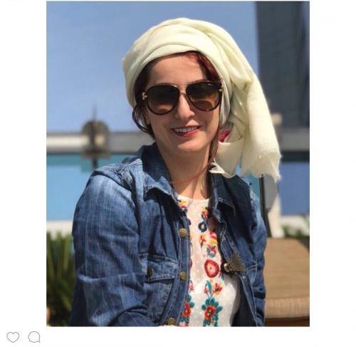 عکس جدید شقایق دهقان بعد از عمل بینی