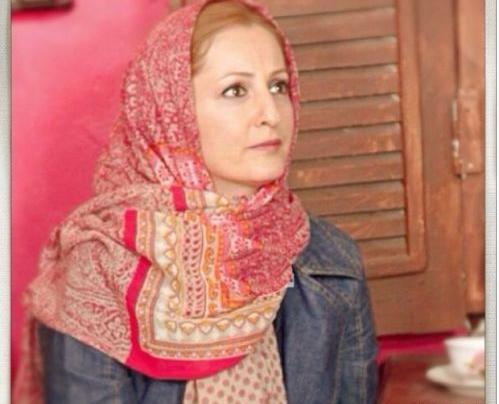 عکس جدید شقایق دهقان بعد از عمل بینی