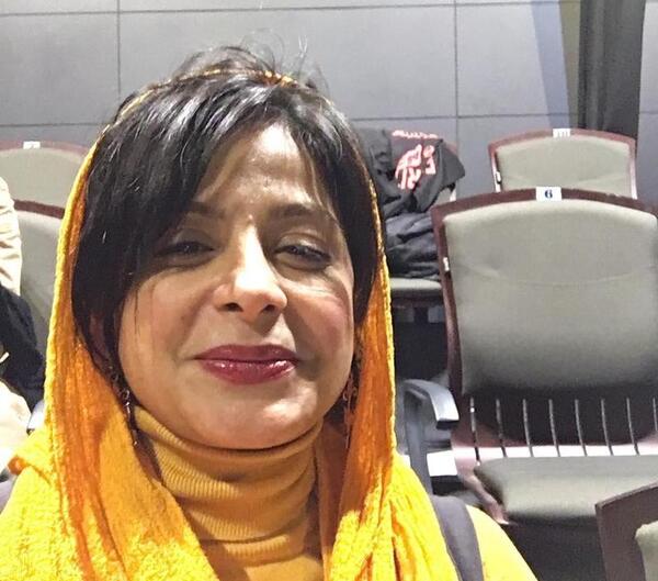 عکس سیما تیرانداز قبل از عمل بینی