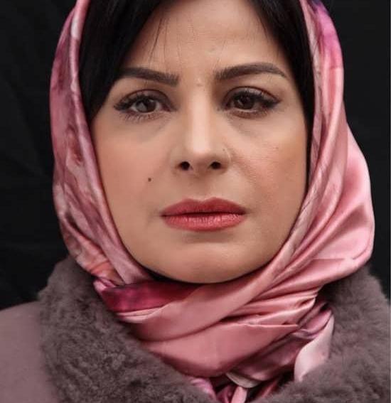 عکس سیما تیرانداز قبل از عمل بینی