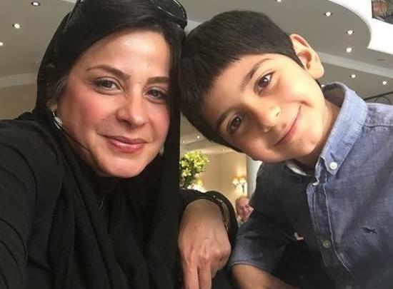 عکس سیما تیرانداز قبل از عمل بینی
