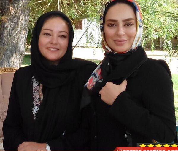 عکس سیما تیرانداز قبل از عمل بینی