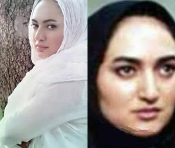 عکس شبنم قلی خانی قبل و بعد از عمل