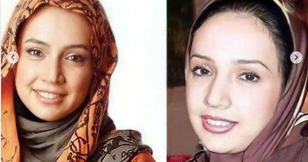 عکس شبنم قلی خانی قبل و بعد از عمل